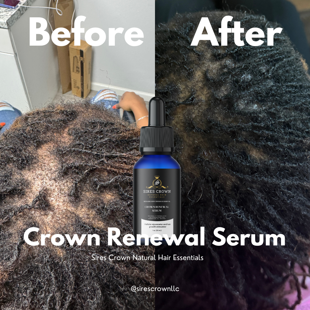 Crown Renewal Serum - 2 oz bottle - Follicle rejuvenator and hair growth stimulator with Biotin, Rosemary, Tea Tree and Horsetail Grass